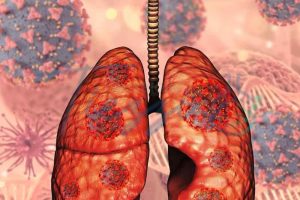 Gamais Interferon IGRA Tuberculose PPD