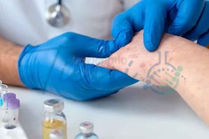Detecção de DNA de Orthopoxvirus